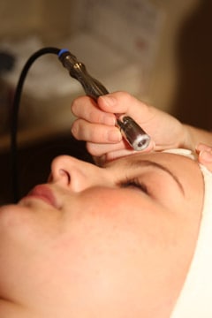 microdermabrasion